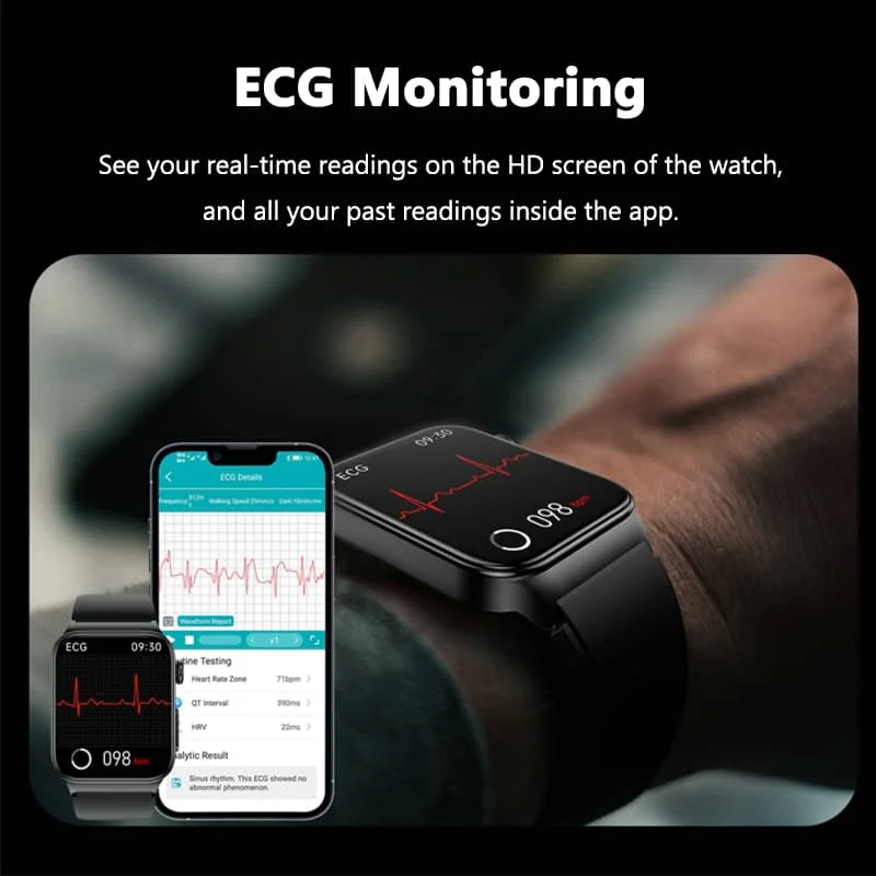 All-in-One Health Smartwatch with ECG, Blood Glucose Monitoring, and Fitness Tracking